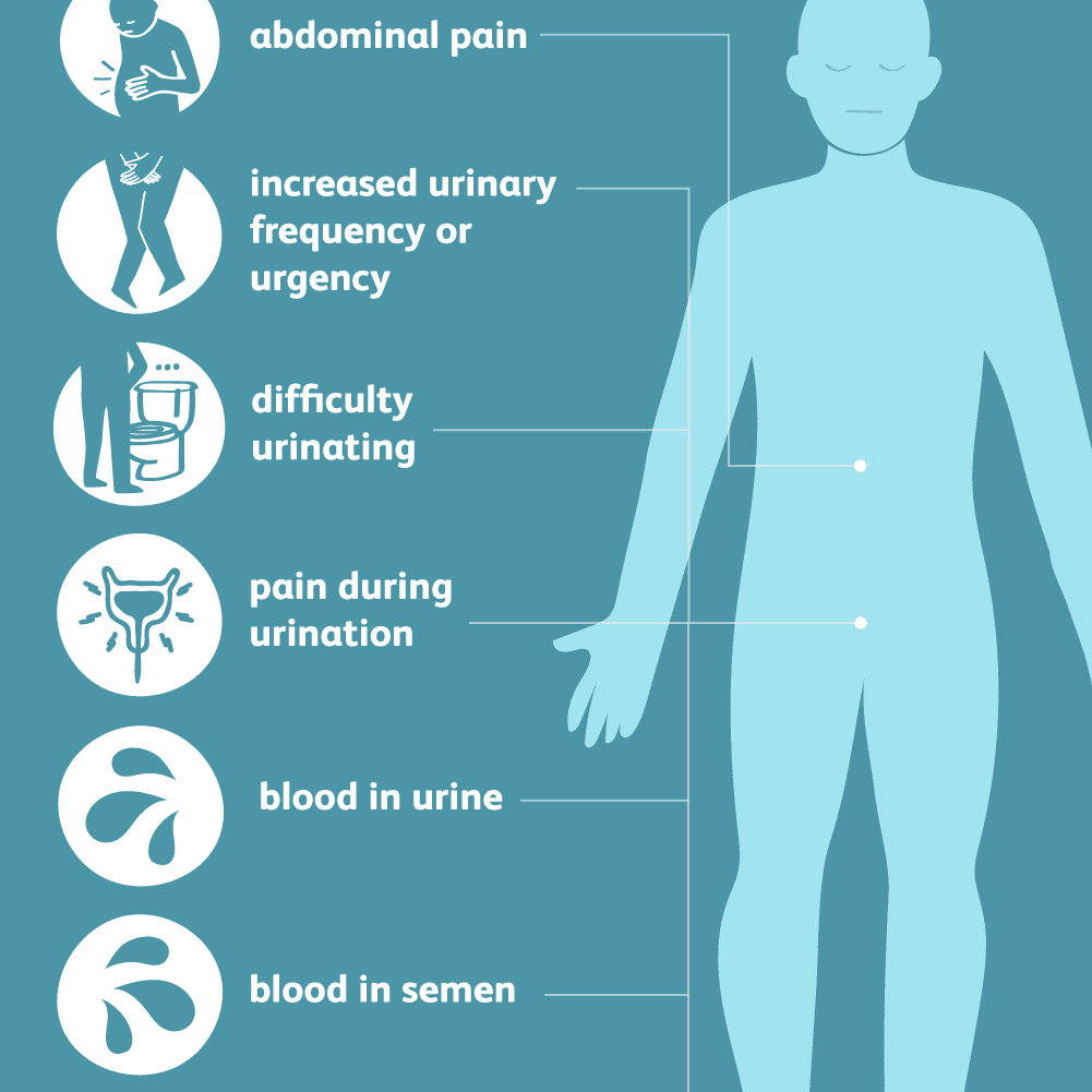 Symptoms of stricture urethra